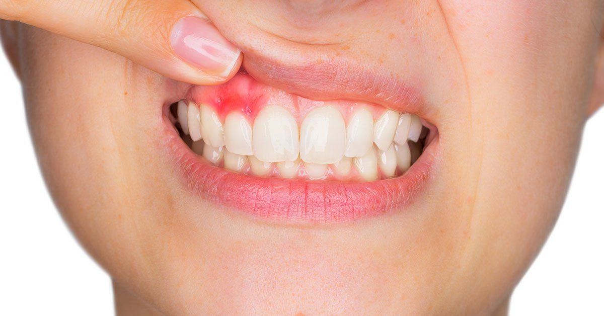 how to prevent gum diseases