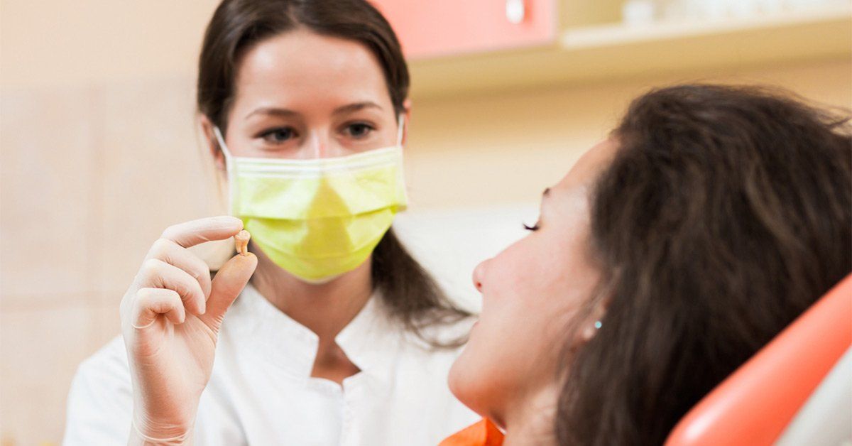 dental extraction