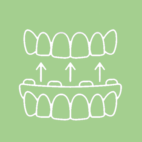 Dental Appliances