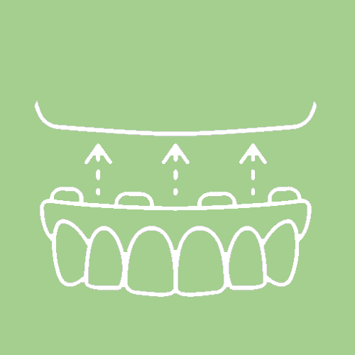 Dentures and Partials Dentures and Partials