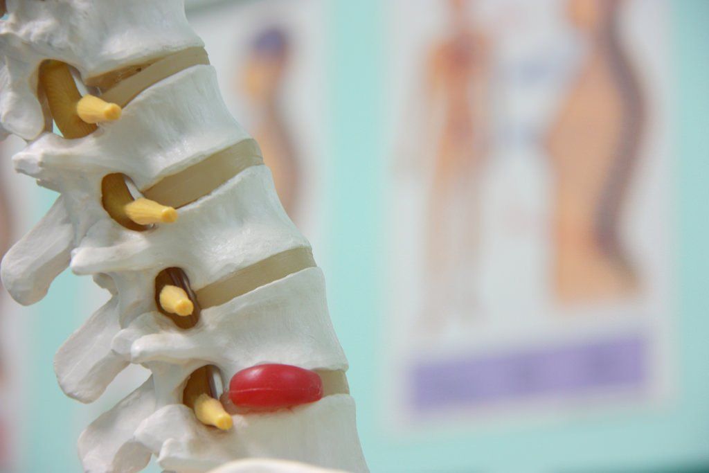 Spinal Decompression Therapy