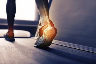 Heel problem