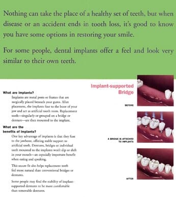 Implants — Tooth Extraction in Wausau, WI Implants — Tooth Extraction in Wausau, WI
