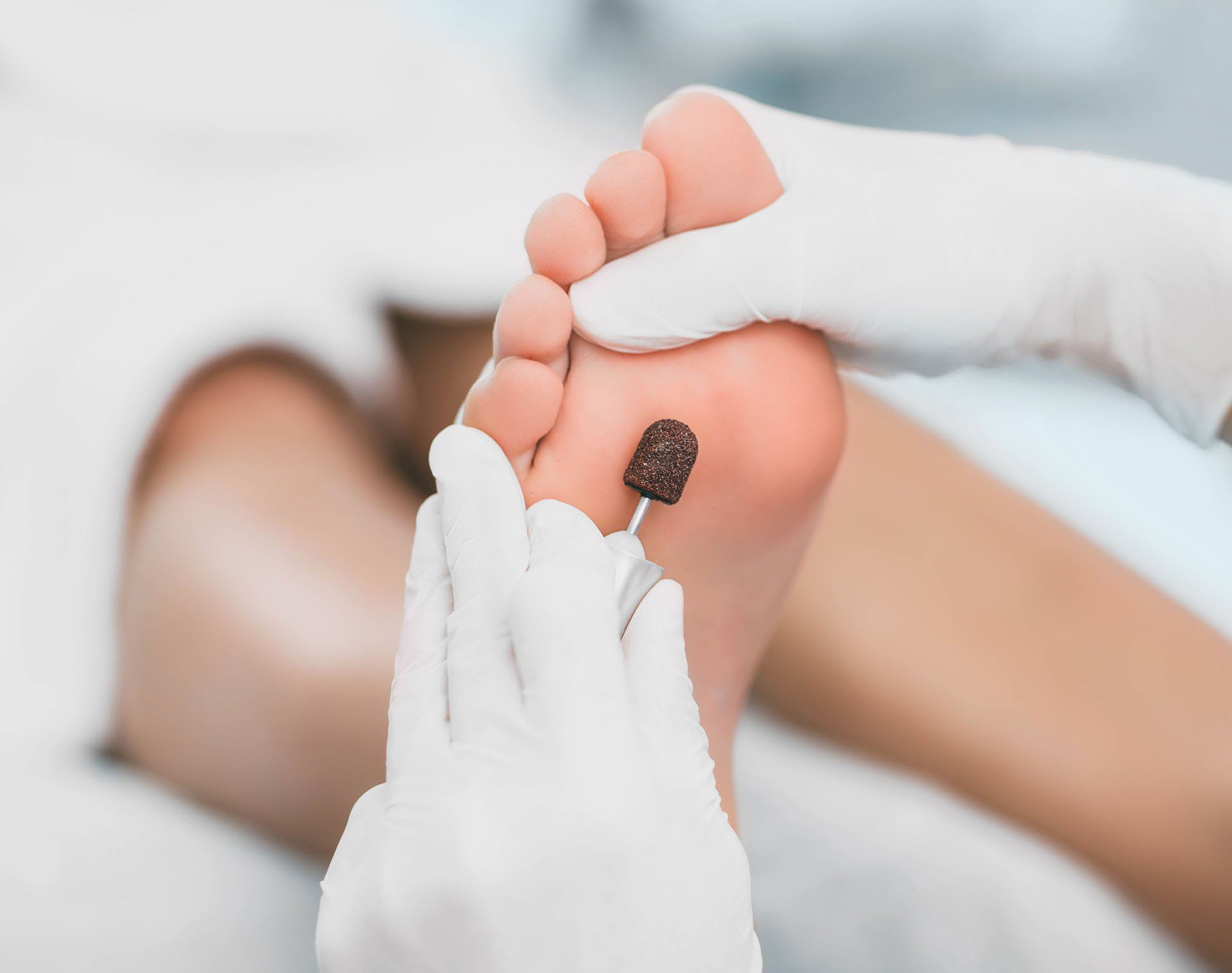 Removal of Hardened Skin on Foot — Alexander City, AL — C & M Enterprise, Inc.