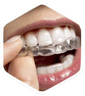 Dental Patient Using Invisalign Braces