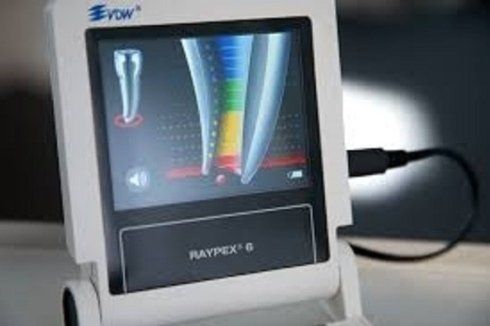trattamento di endodonzia
