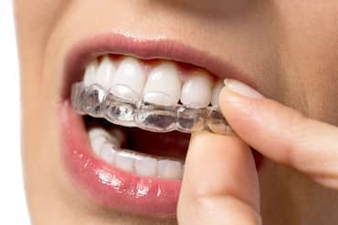 Silicone Trainer - Dental Care in Haute, IN Silicone Trainer - Dental Care in Haute, IN