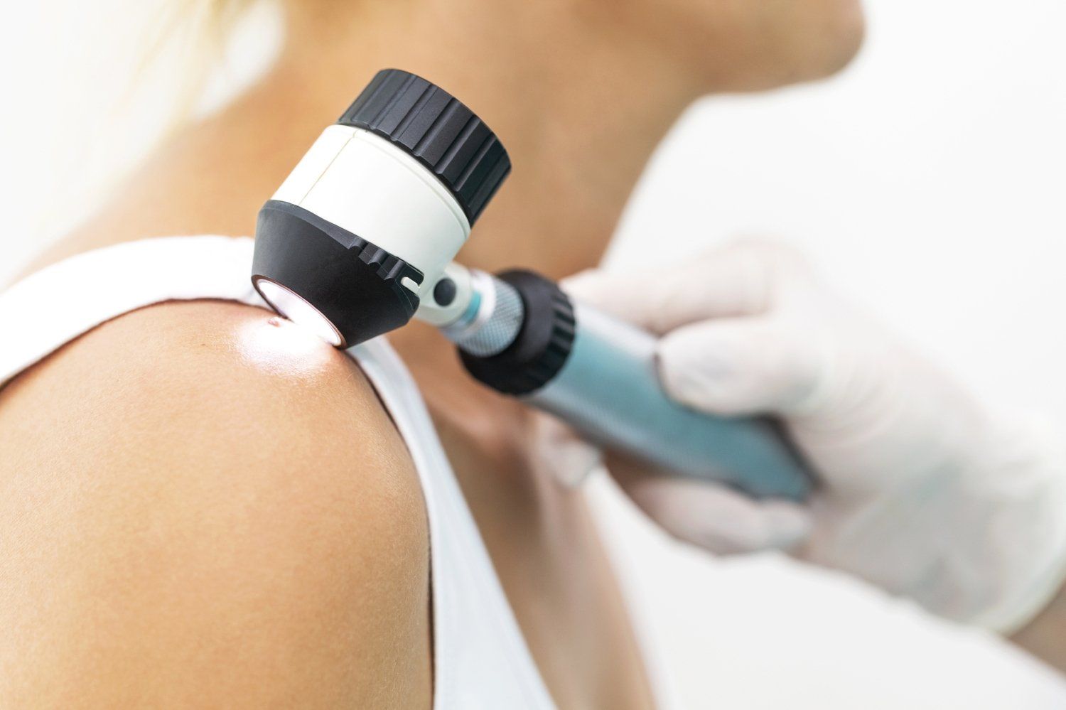Uma mulher está tendo sua pele examinada por um médico