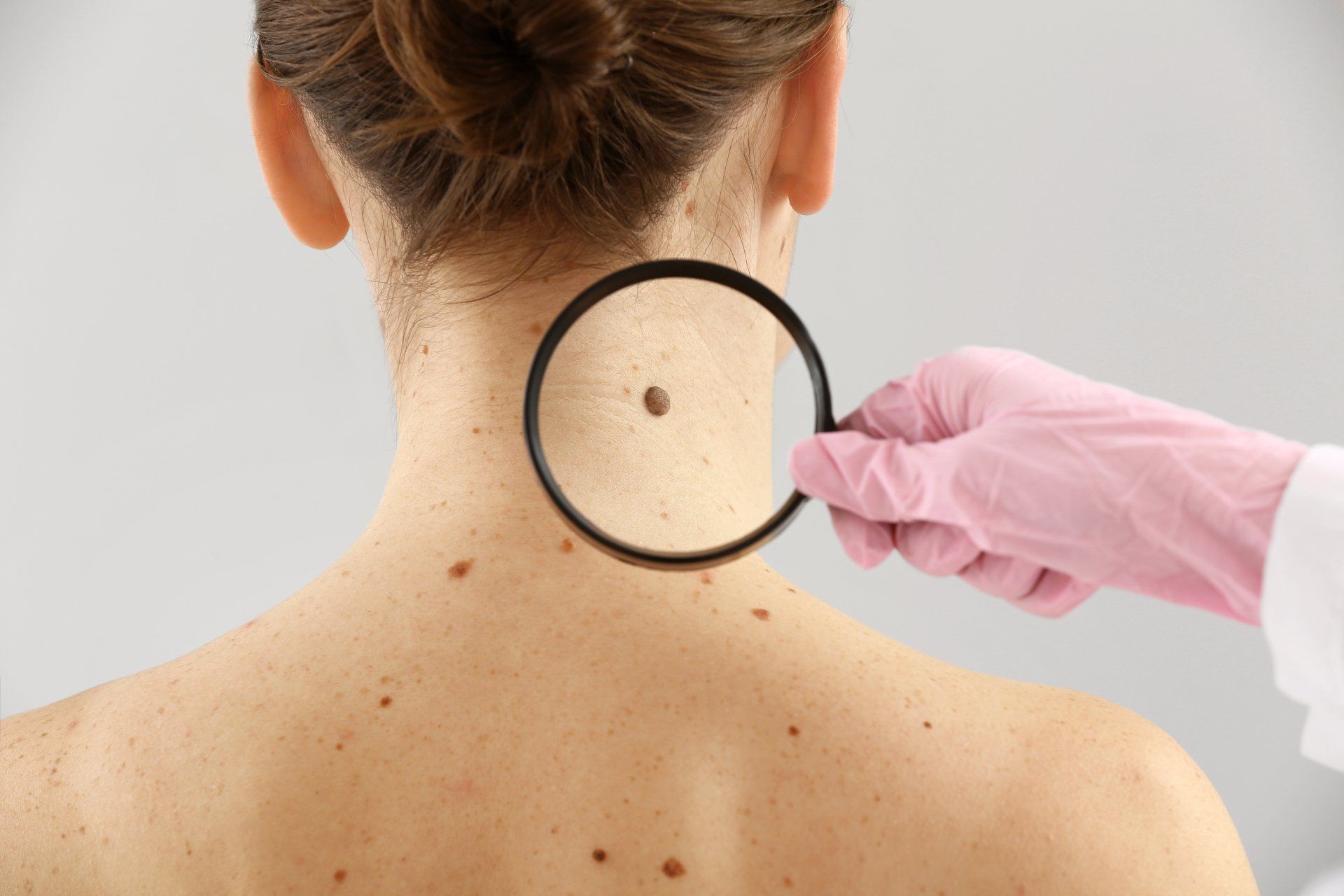 Um médico examina a pele de uma mulher com uma lupa.
