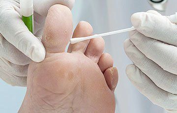 Hard skin removal