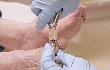 Nail cutting