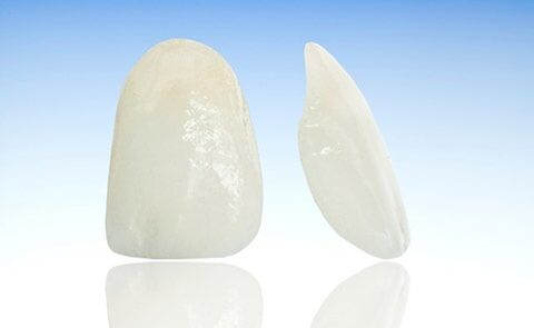 Porcelain Laminate - Veneers in Farmingdale, NY