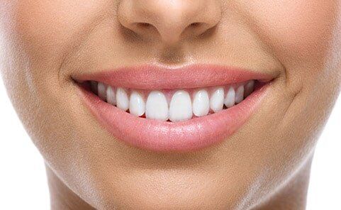 Dental Bonding - Dental Care in Farmingdale, NY