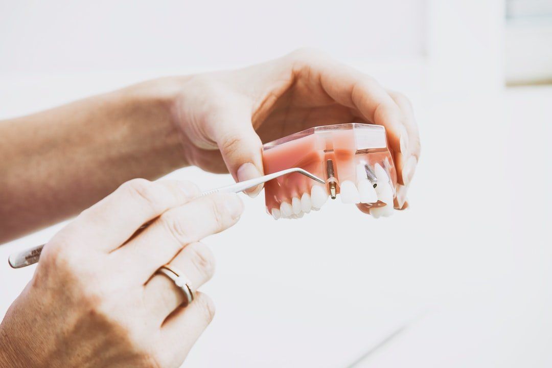 Dentist explaining dental implant