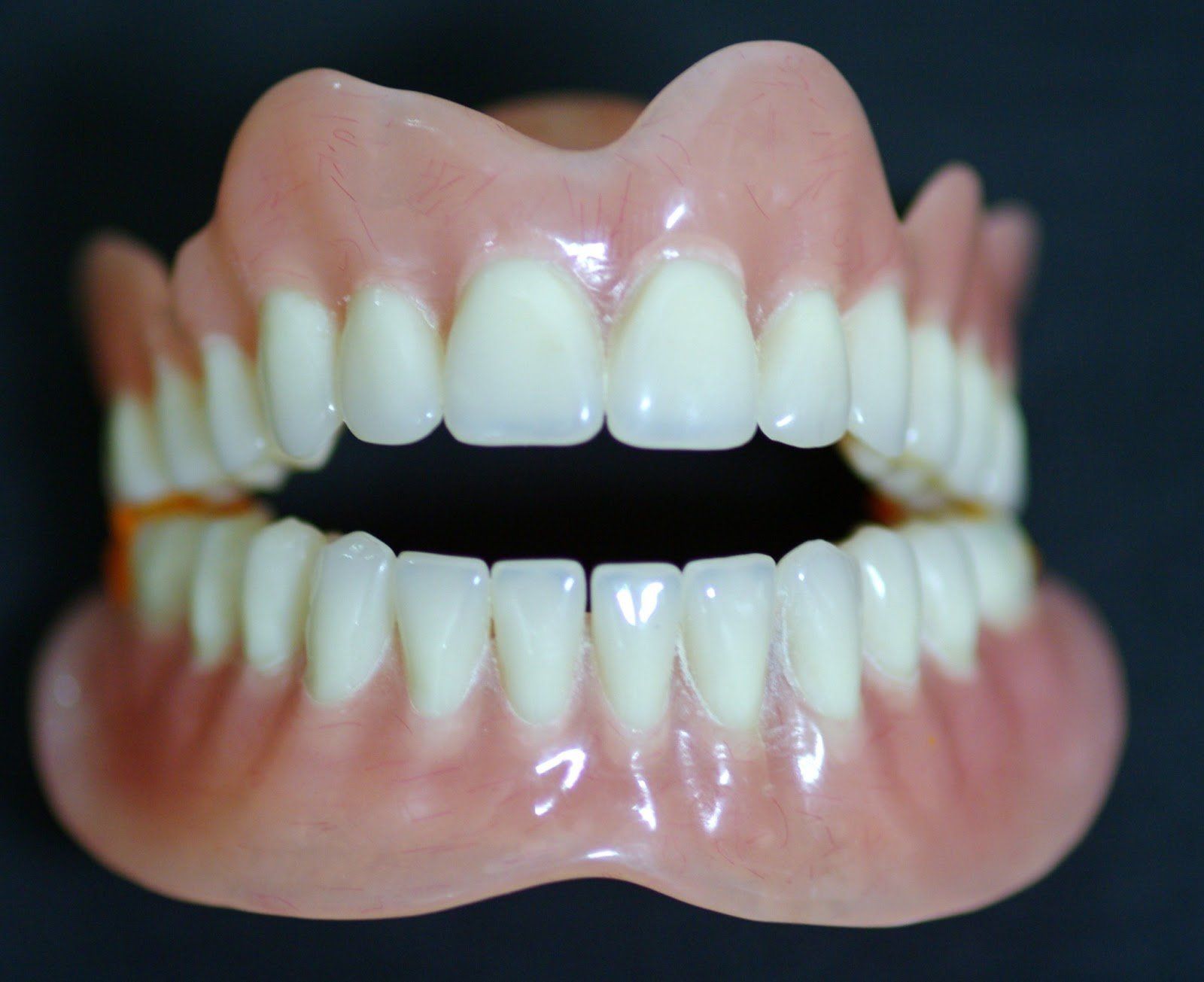 model of tooth restoration for dental care