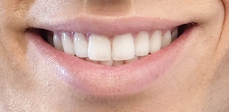 Man's mouth with beautiful white teeth.