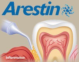 Arestin fights tooth infection and speeds healing.