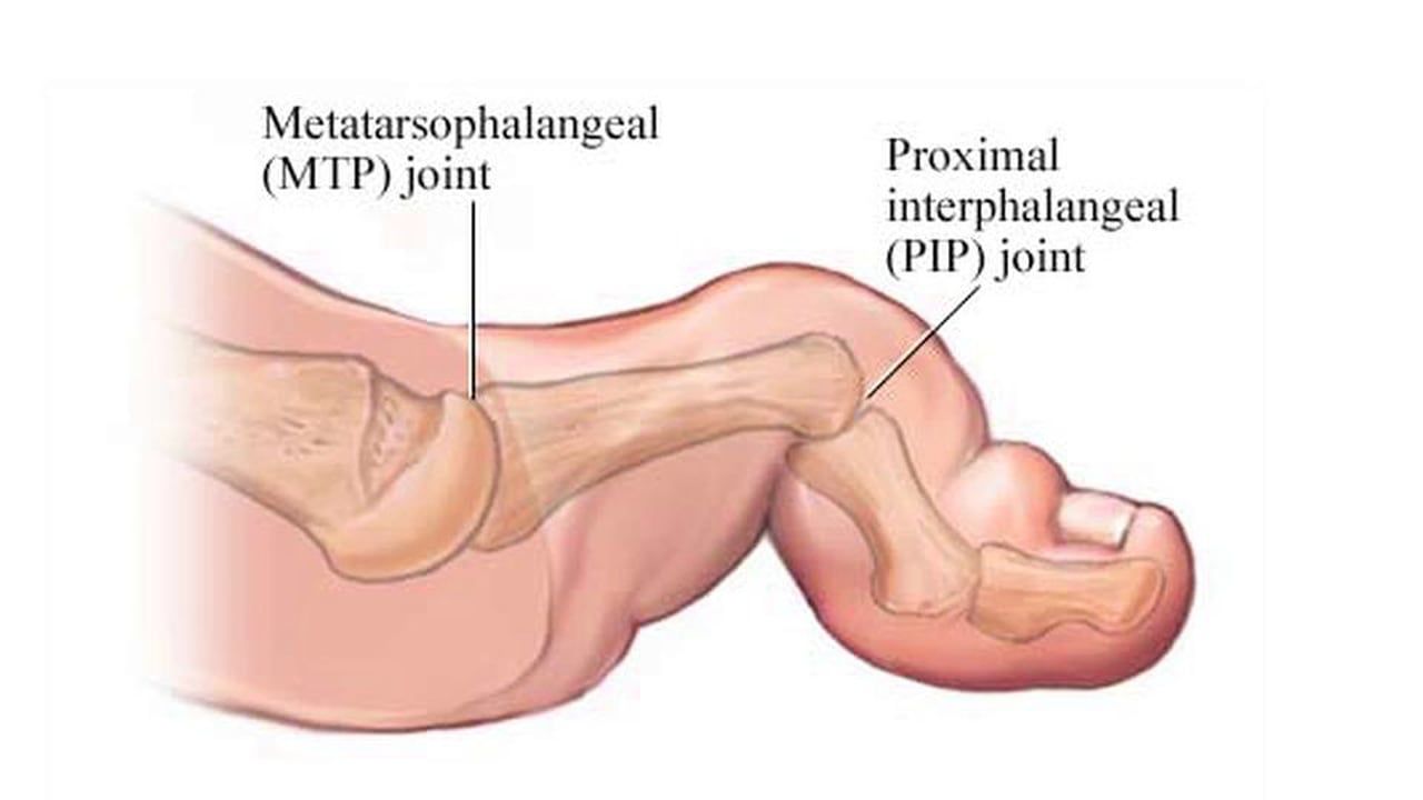 foot pain treatment silver spring md