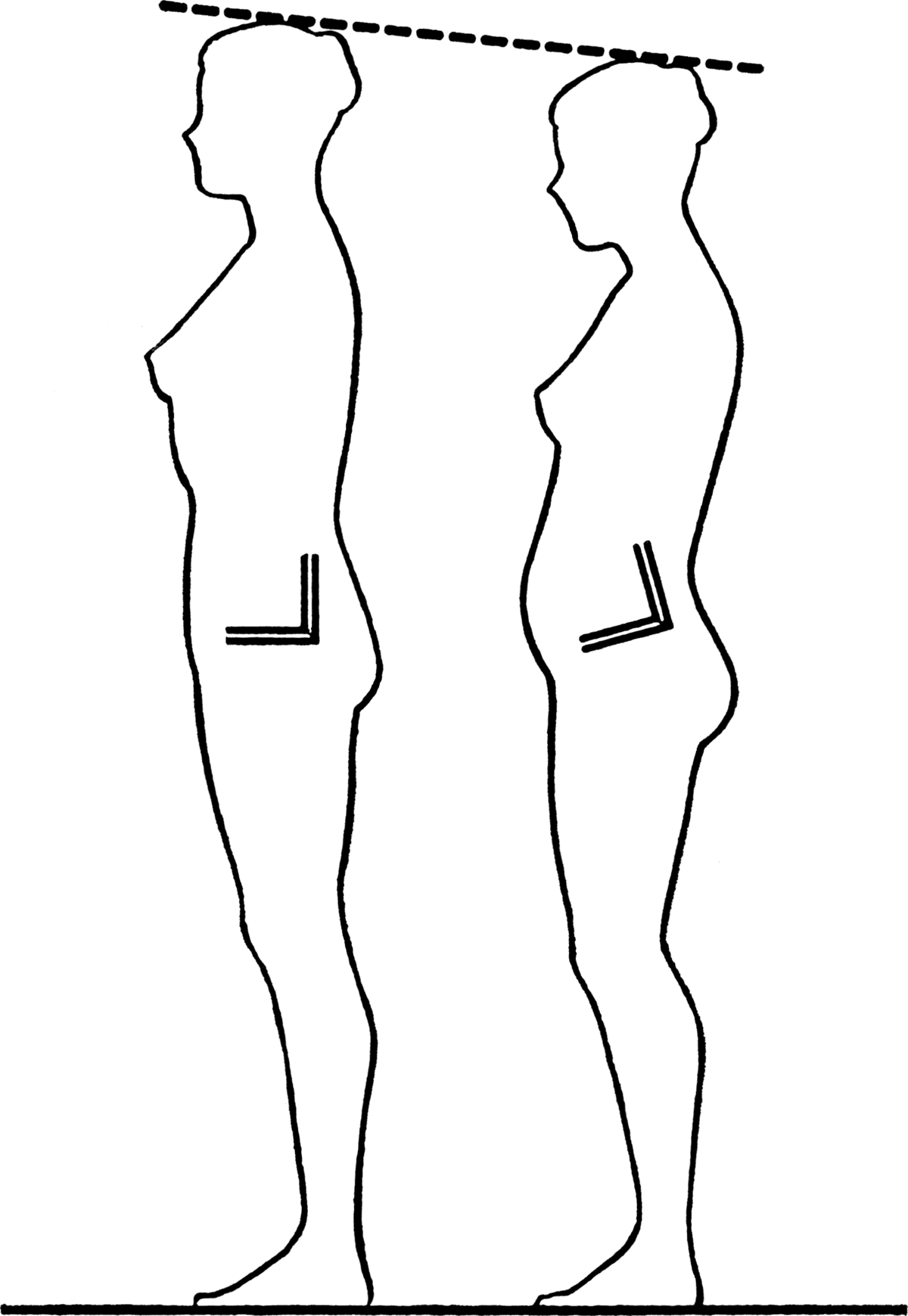 low back pain st petersburg