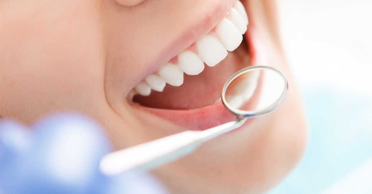 Smile Makeover at Broadway Dental