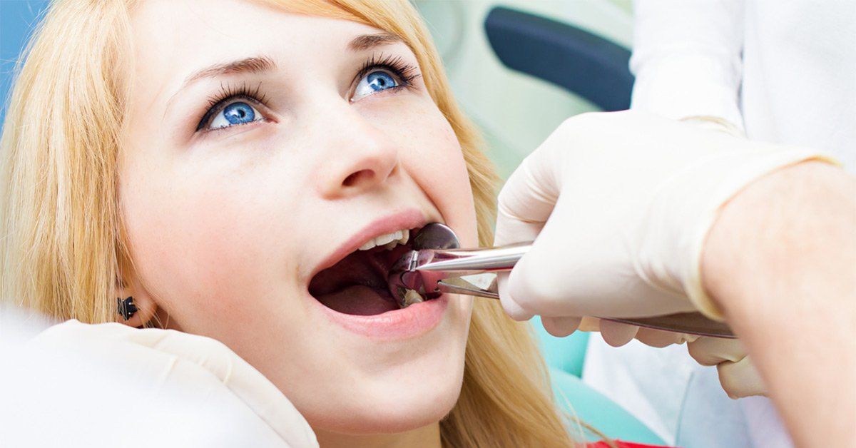 dental extraction