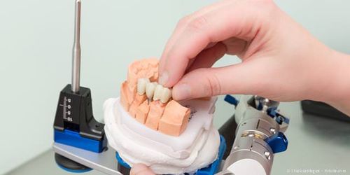 Zahntechnik: Wie Zahnersatz im Dentallabor hergestellt wird Zahntechnik: Wie Zahnersatz im Dentallabor hergestellt wird