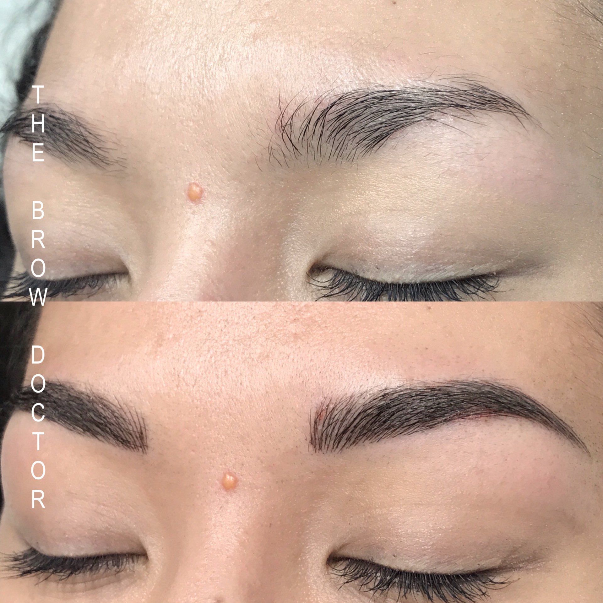 Before and After