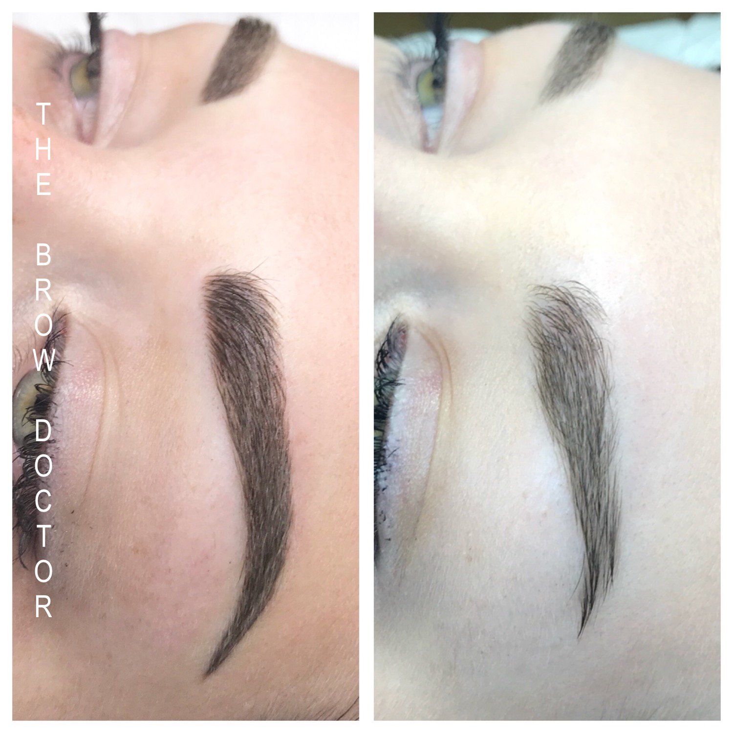 Before and After