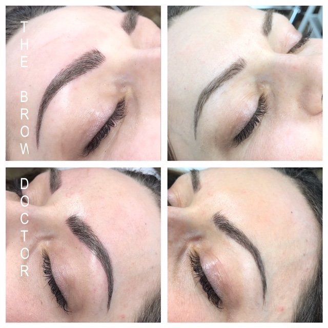 Before and After Micro-Blading