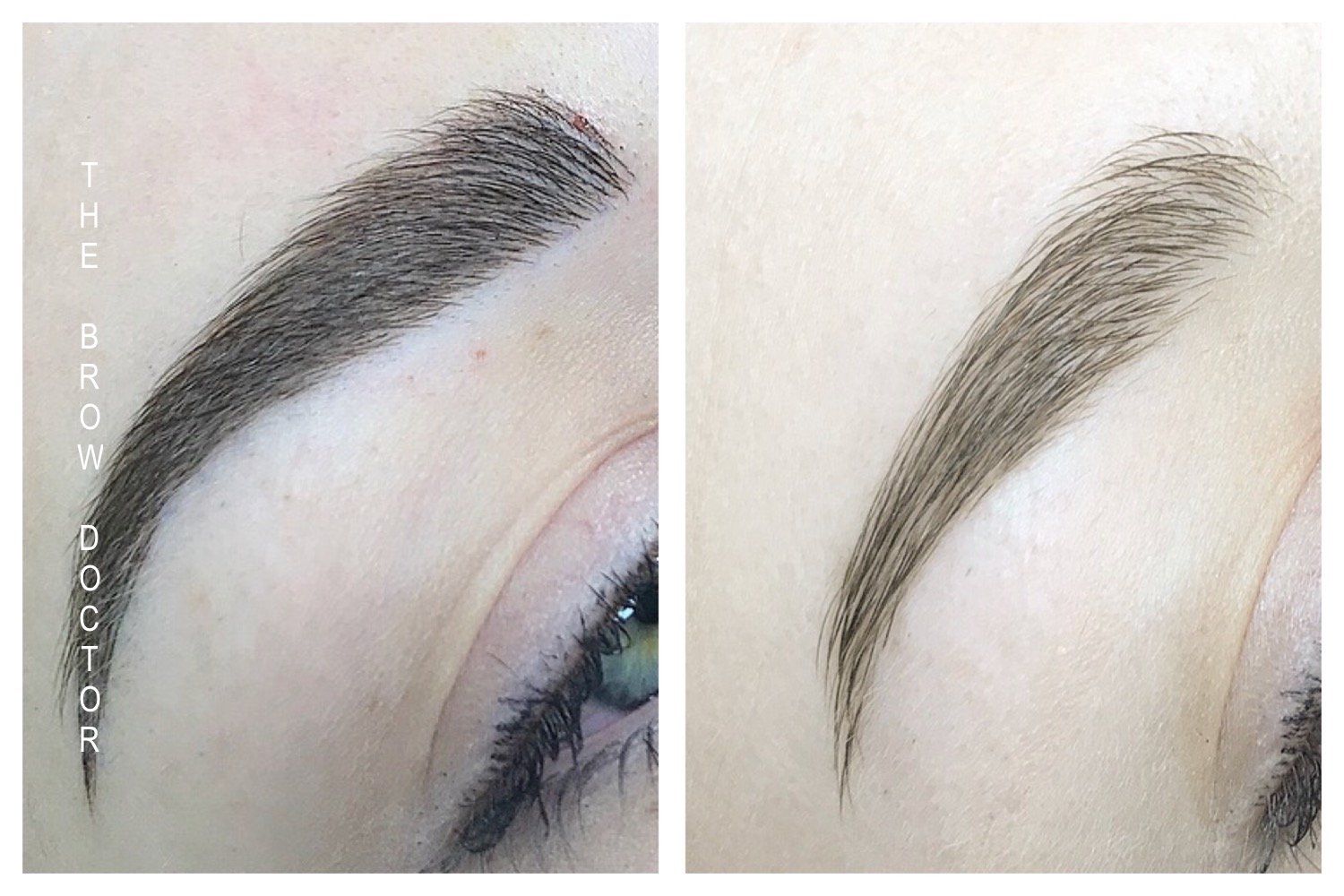 Before and After Micro-Blading
