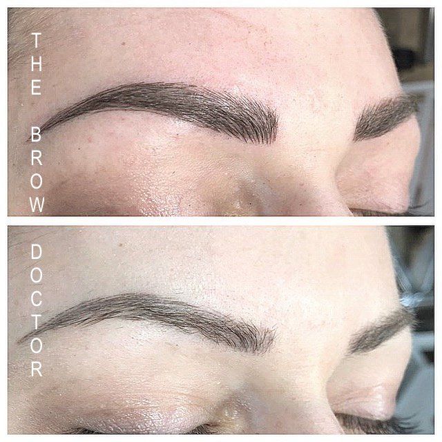 Before and After Micro-Blading