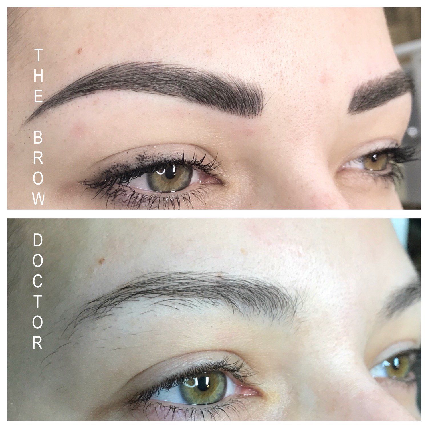 Before and After