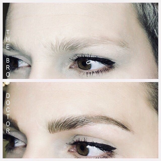 Before and After Micro-Blading 