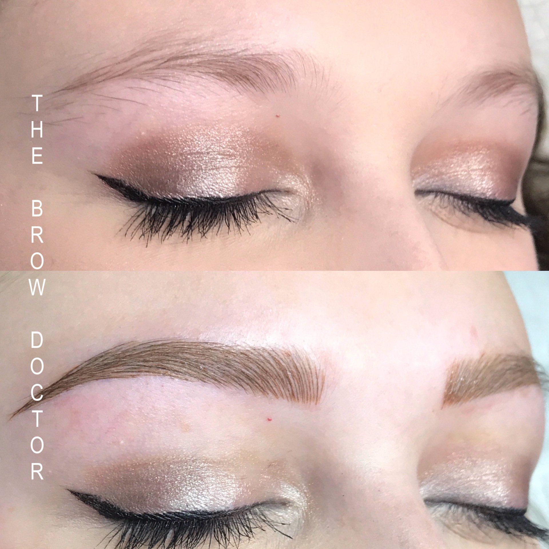 Before and After