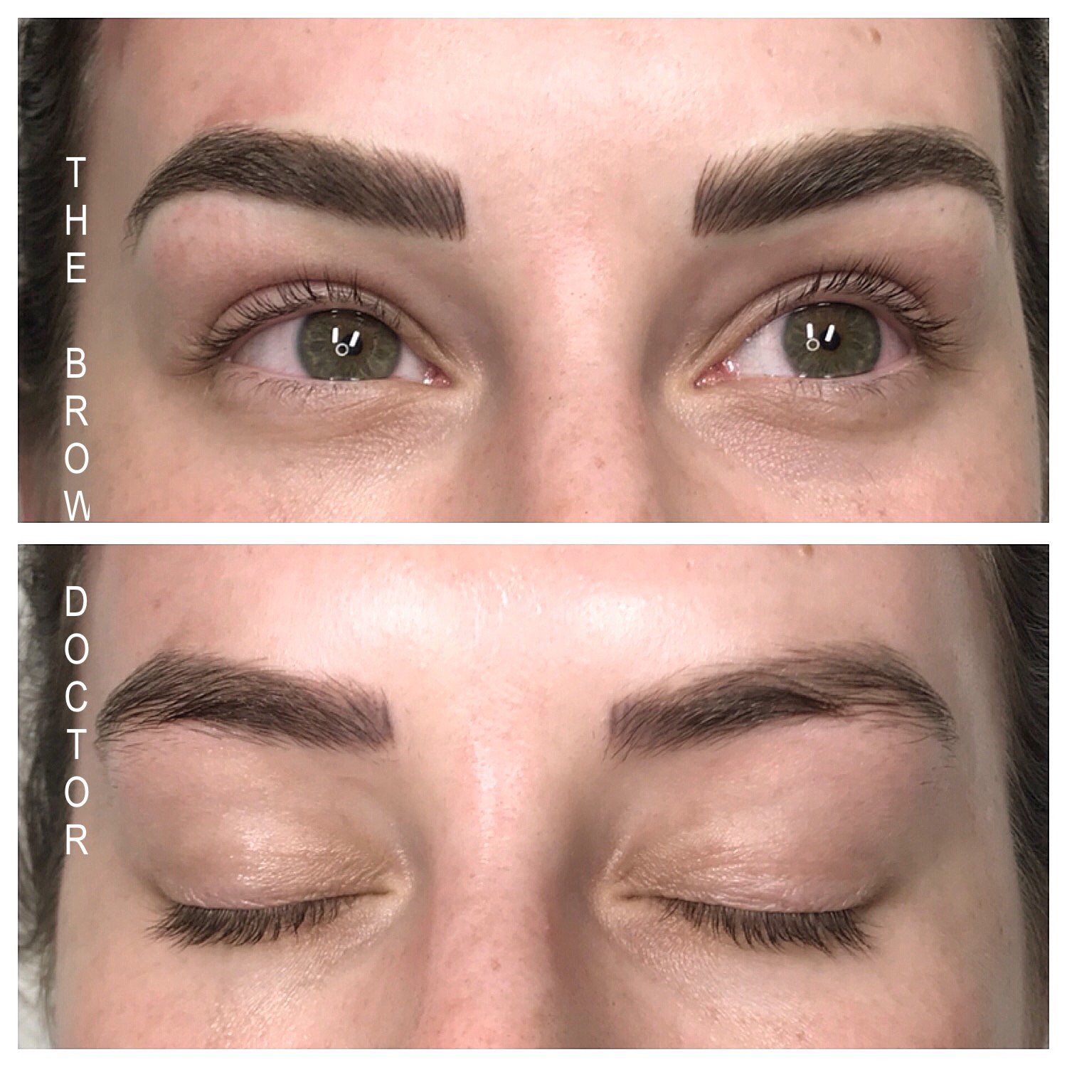 Before and After