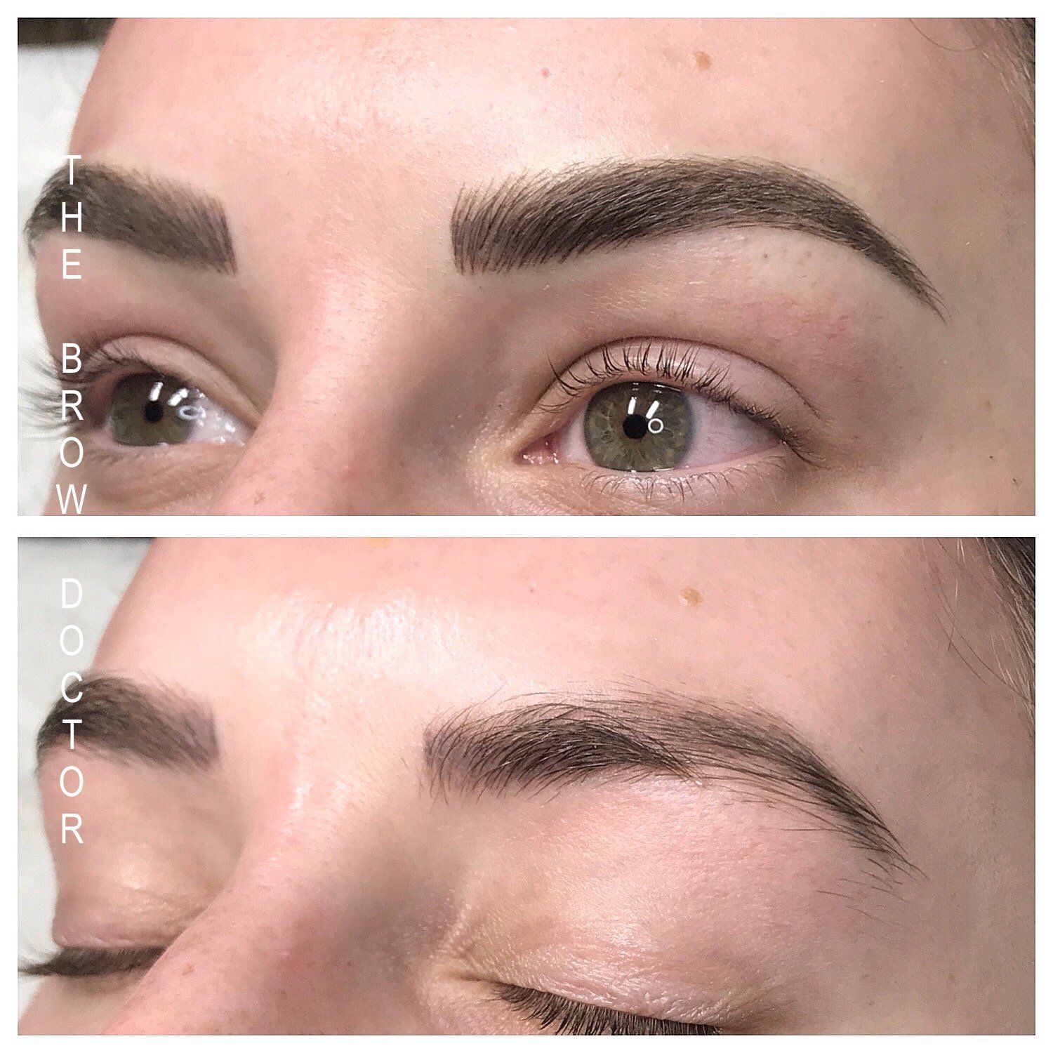 Before and After