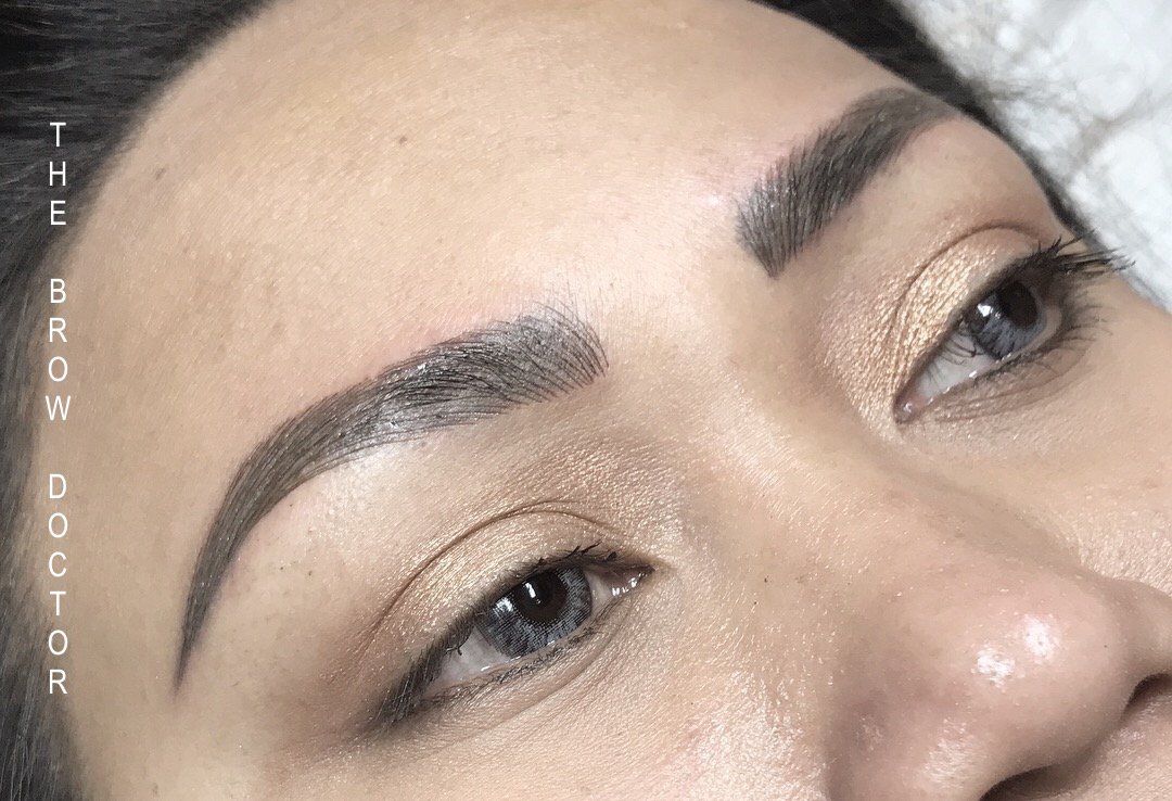 Before and After