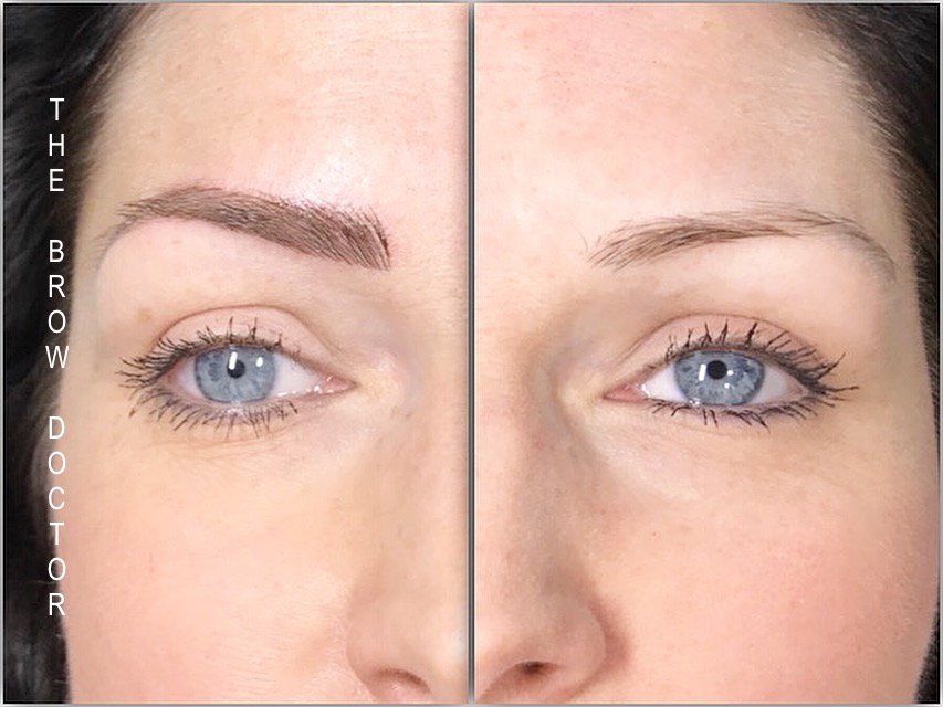 Before and After Micro-Blading