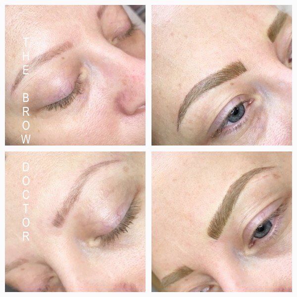 Before and After Micro-Blading 
