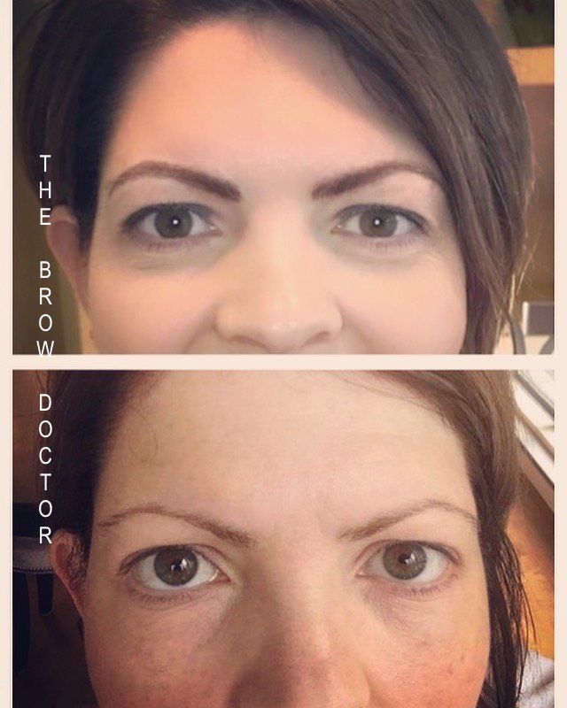 Before and After Micro-Blading 