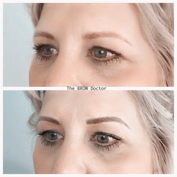 Before and After MicroBlading 