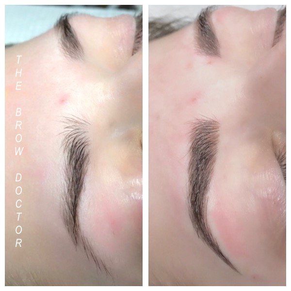 Before and After Micro-Blading BC