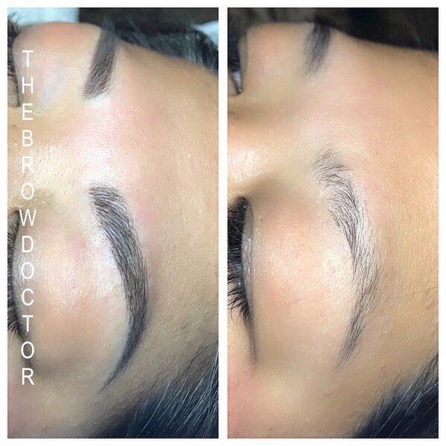 Before and After Micro-Blading White Rock