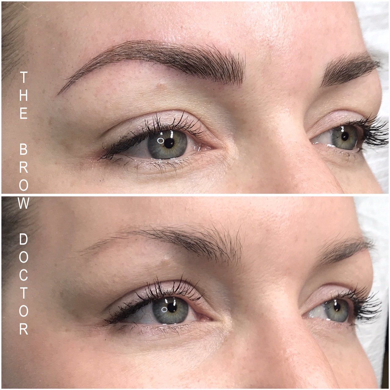 Before and After