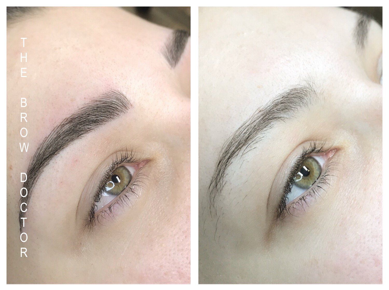 Before and After Micro-Blading