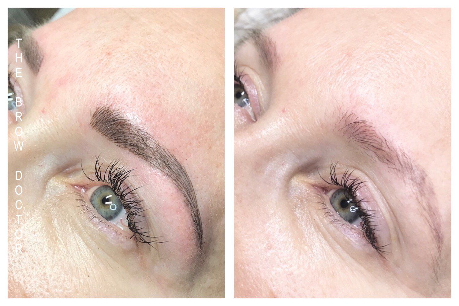 Before and After