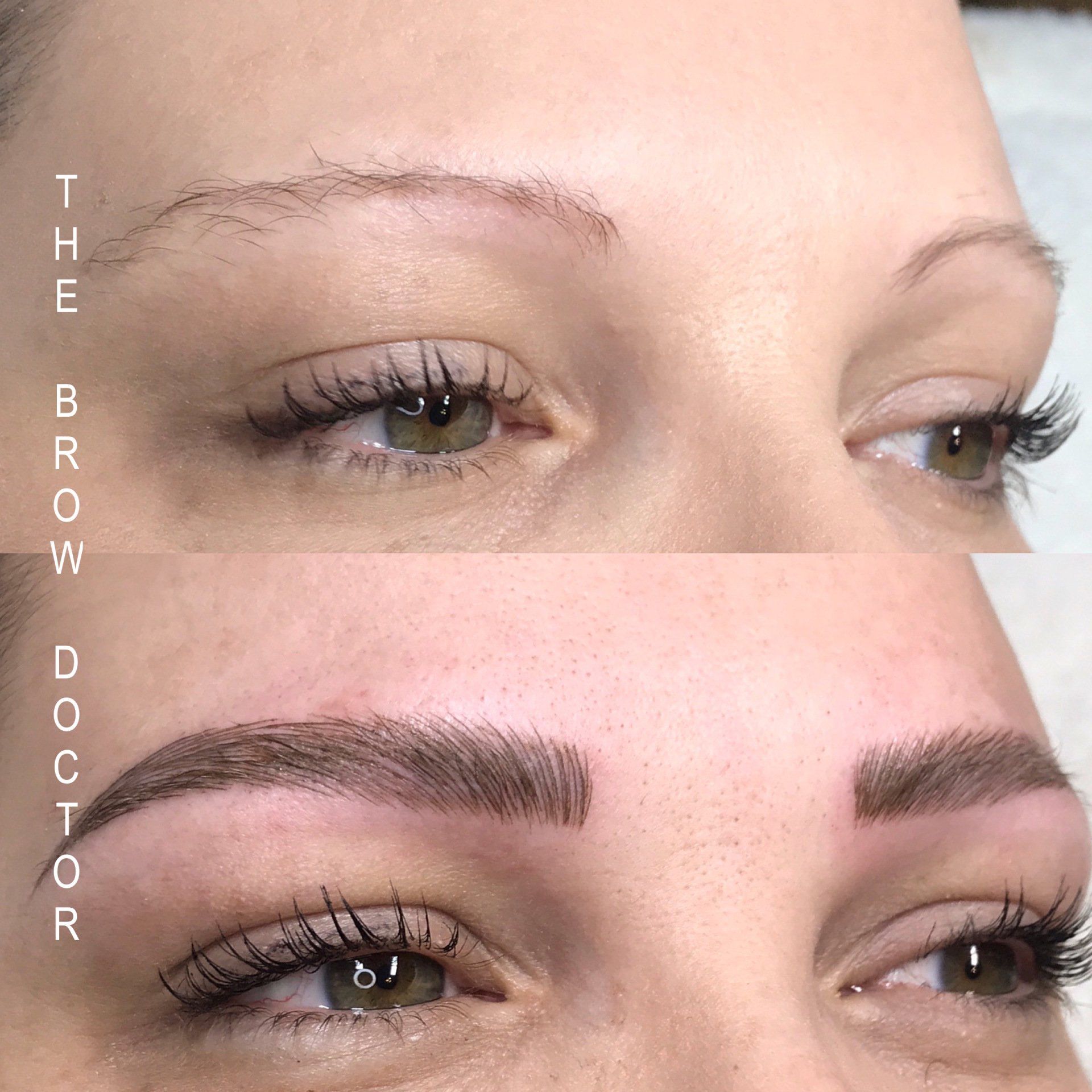 Before and After