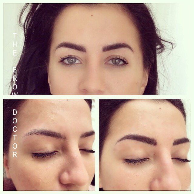 Before and After Micro-Blading BC