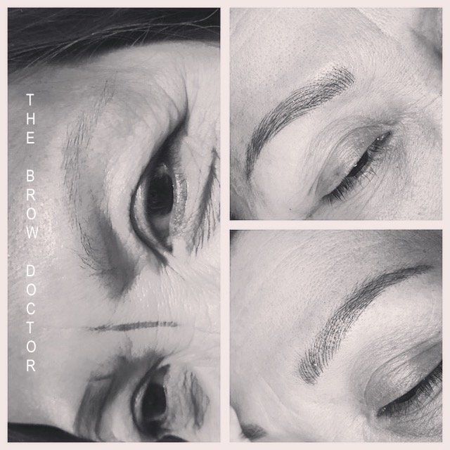 Before and After Micro-Blading South Surrey