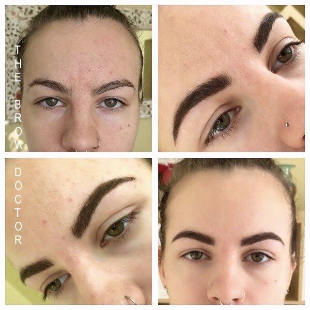 Before and After Micro-Blading Willowbrook